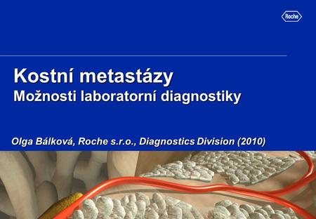 Kostní metastázy Možnosti laboratorní diagnostiky