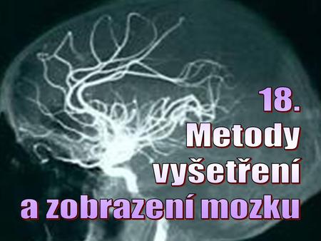 18. Metody vyšetření a zobrazení mozku.