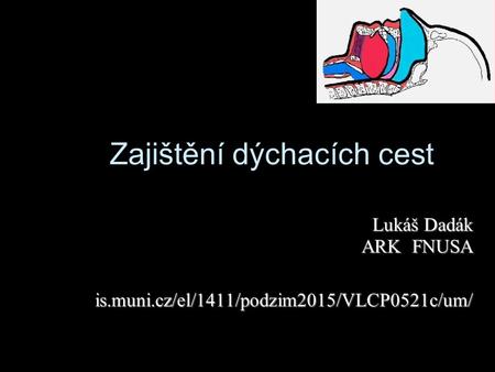 Zajištění dýchacích cest Lukáš Dadák ARK FNUSA is.muni.cz/el/1411/podzim2015/VLCP0521c/um/