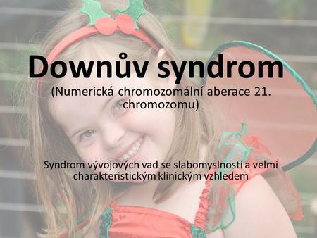 Downův syndrom (Numerická chromozomální aberace 21. chromozomu) Syndrom vývojových vad se slabomyslností a velmi charakteristickým klinickým vzhledem.