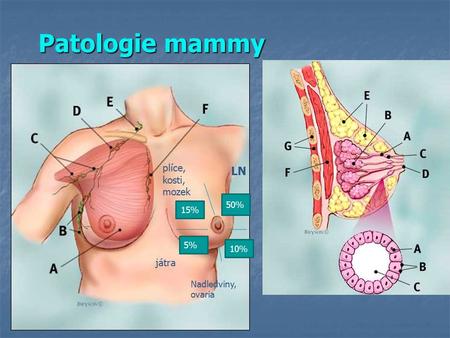 Patologie mammy 15% 5% 50% 10% Nadledviny, ovaria játra plíce, kosti, mozek LN.