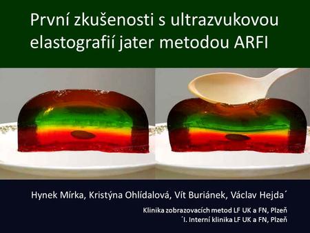 První zkušenosti s ultrazvukovou elastografií jater metodou ARFI