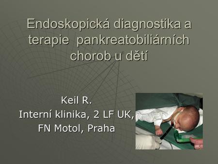 Endoskopická diagnostika a terapie pankreatobiliárních chorob u dětí