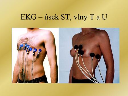 EKG – úsek ST, vlny T a U.
