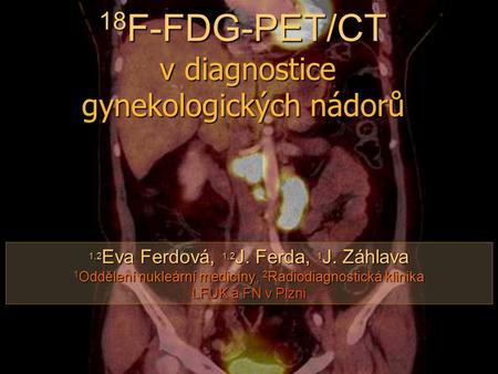 18F-FDG-PET/CT v diagnostice gynekologických nádorů