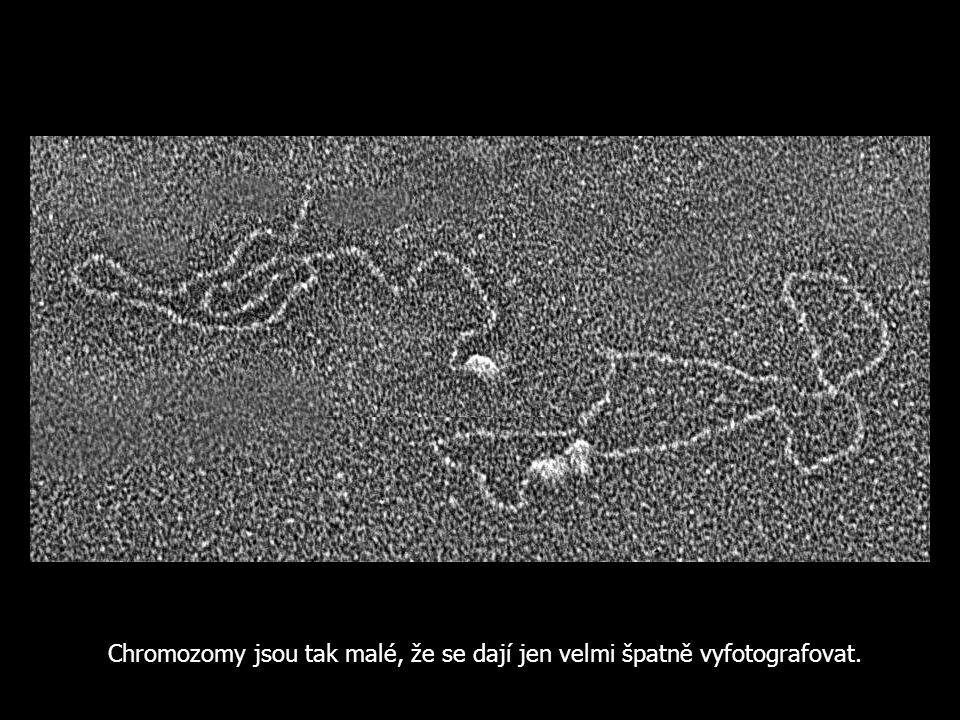 Chromozomy jsou tak malé, že se dají jen velmi špatně vyfotografovat.