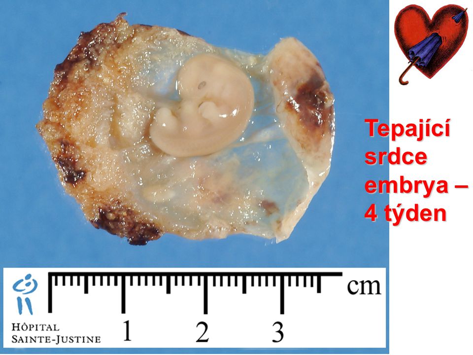 Tepající srdce embrya – 4 týden