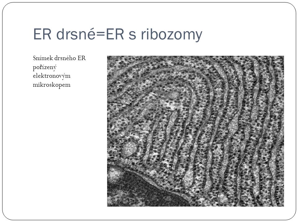 ER drsné=ER s ribozomy Snímek drsného ER pořízený elektronovým mikroskopem