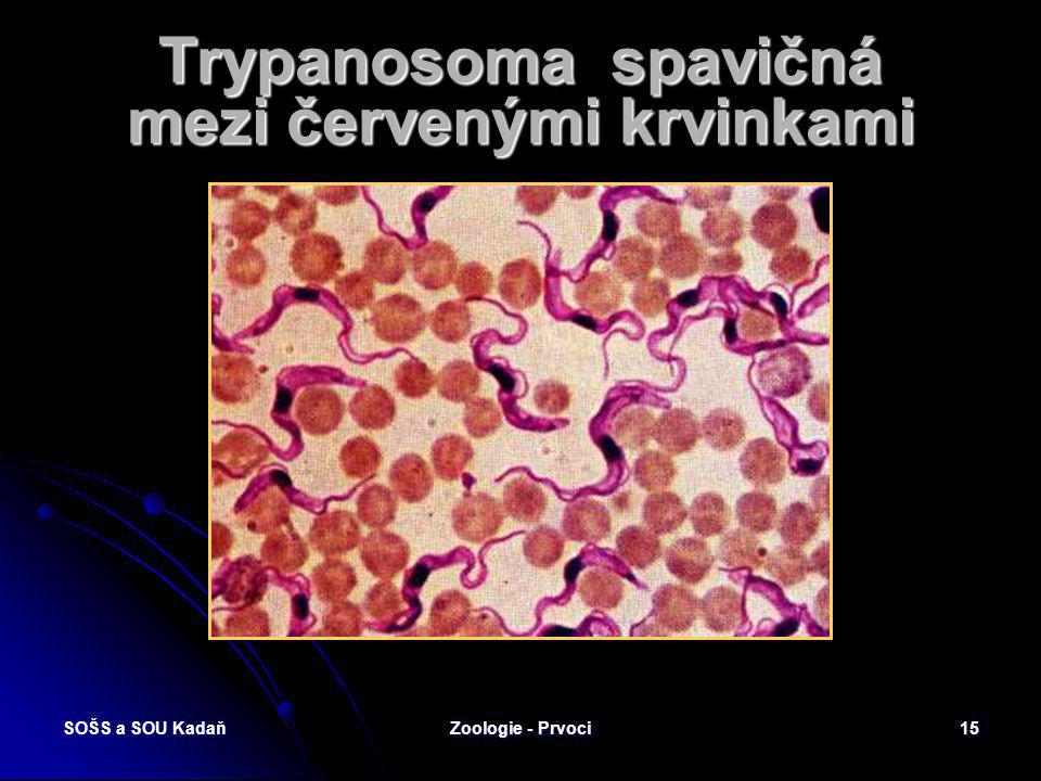 Trypanosoma spavičná mezi červenými krvinkami
