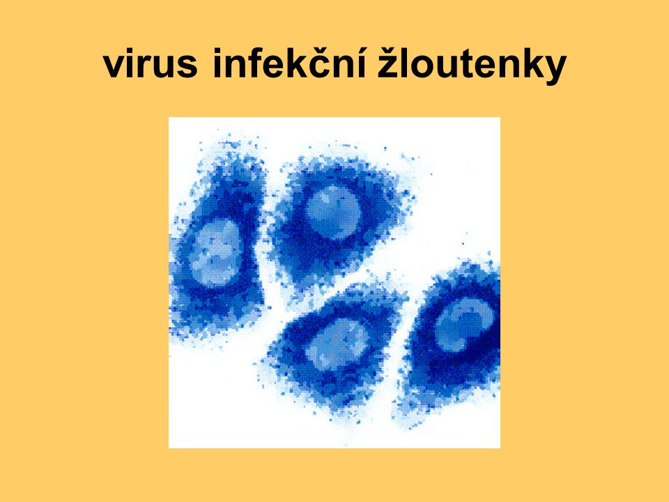 virus infekční žloutenky
