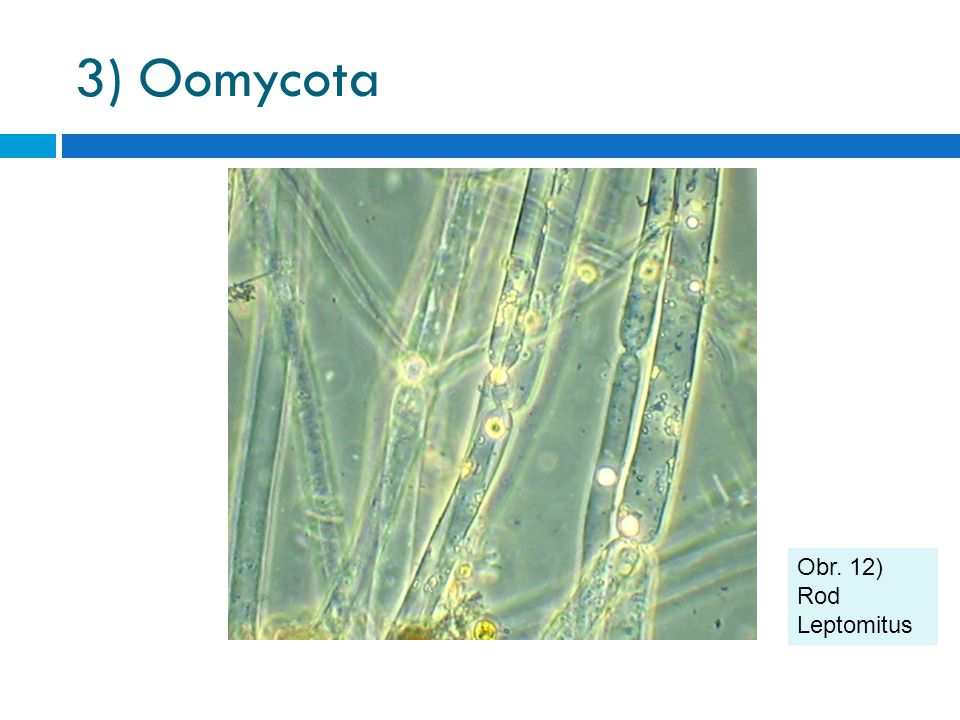 3) Oomycota Obr. 12) Rod Leptomitus