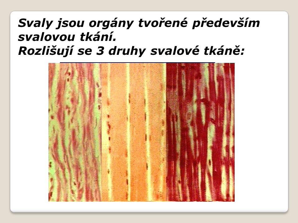 Svaly jsou orgány tvořené především svalovou tkání