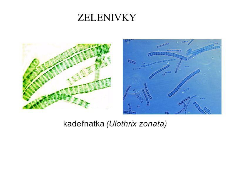 ZELENIVKY kadeřnatka (Ulothrix zonata)
