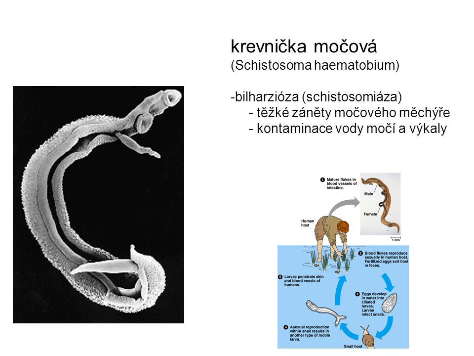 krevnička močová (Schistosoma haematobium)