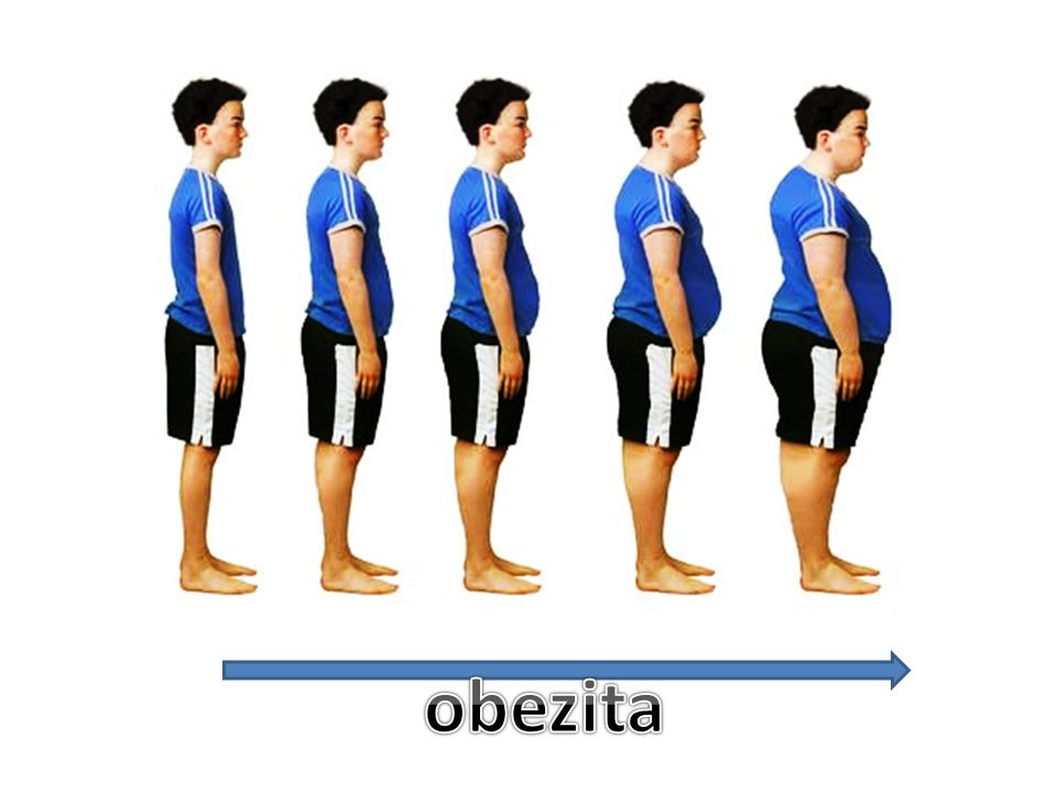 obezita