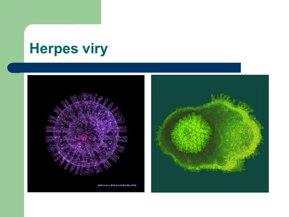 Herpes viry