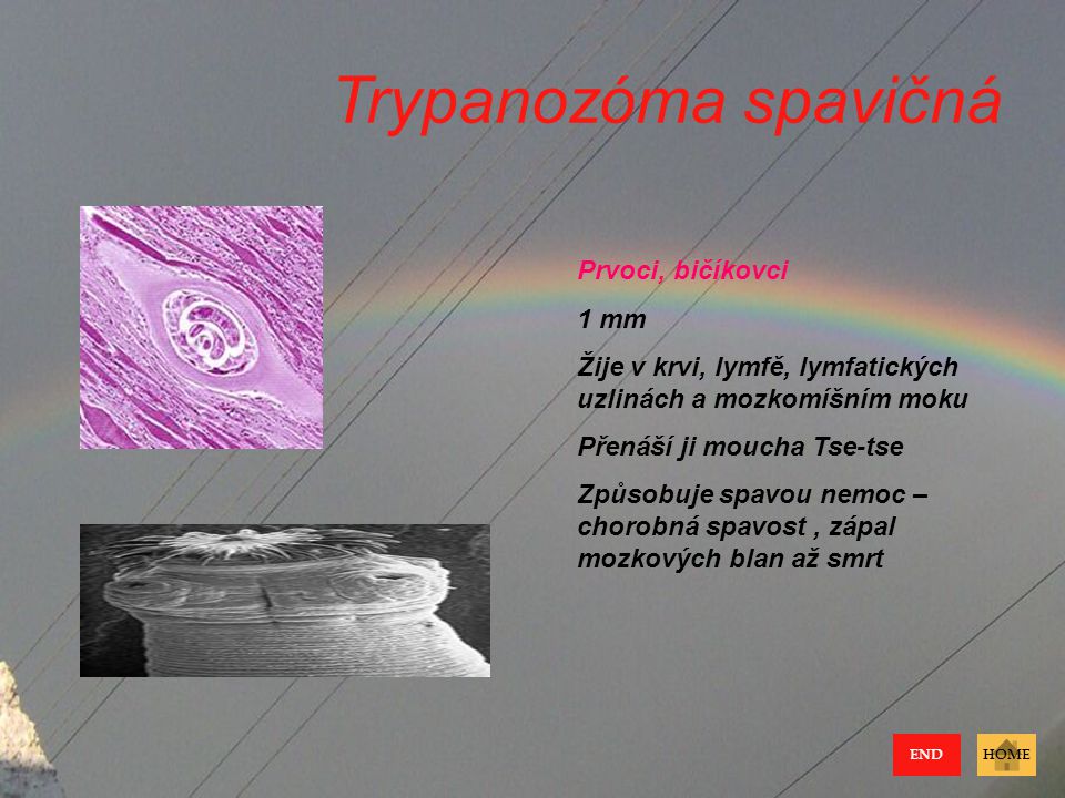 Trypanozóma spavičná Prvoci, bičíkovci 1 mm