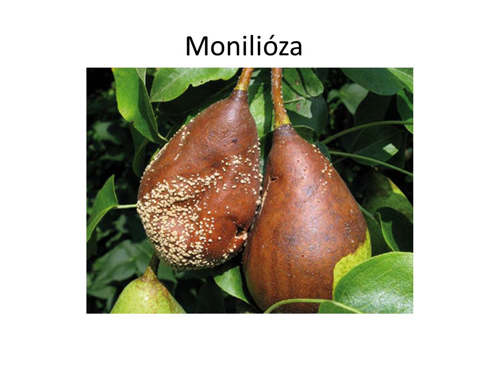 Monilióza