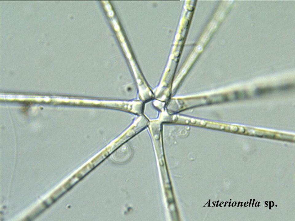 Asterionella sp.