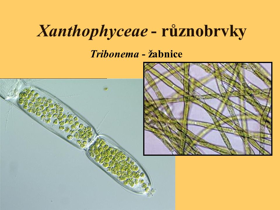 Xanthophyceae - různobrvky