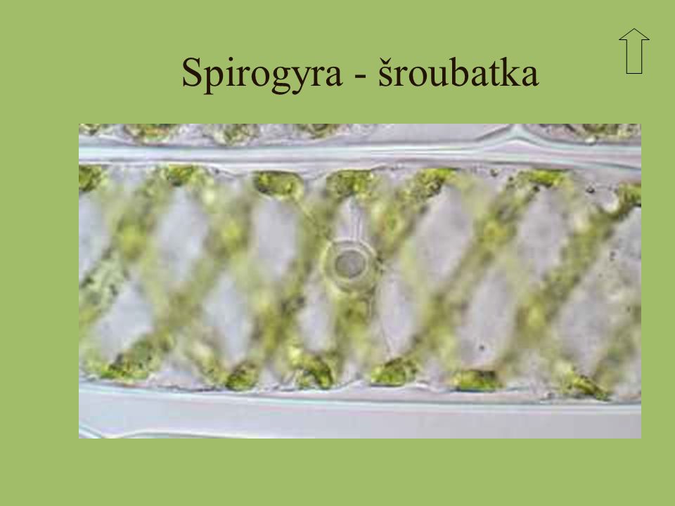Spirogyra - šroubatka