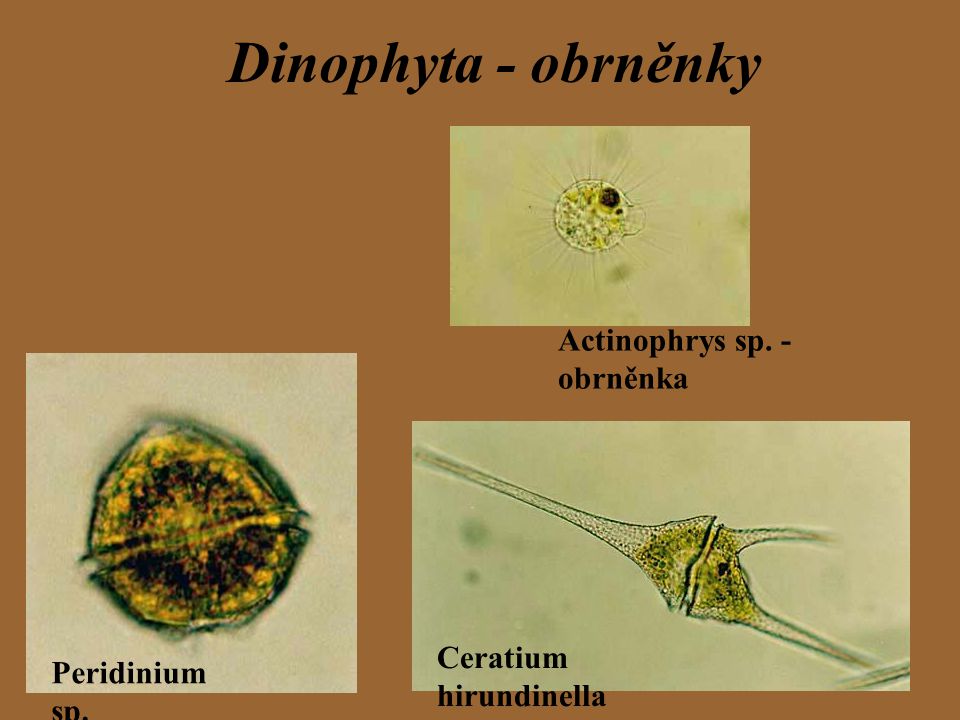 Dinophyta - obrněnky Actinophrys sp. - obrněnka Ceratium hirundinella