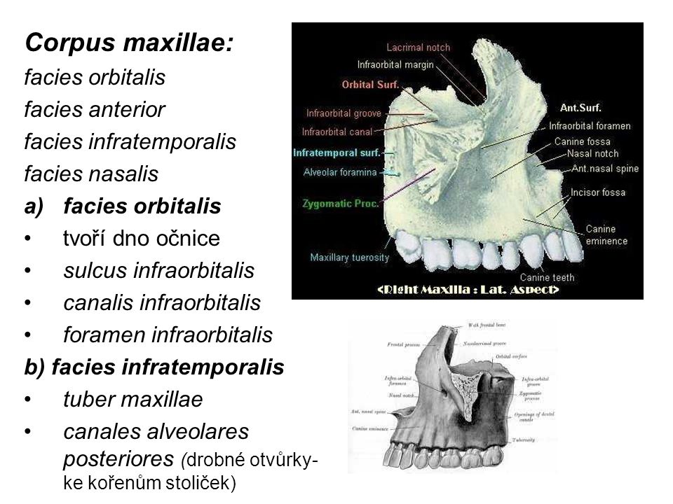 Corpus maxillae: facies orbitalis facies anterior