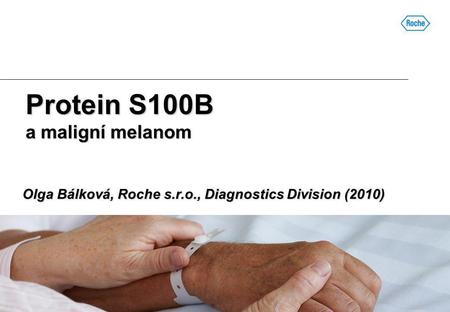 Protein S100B a maligní melanom