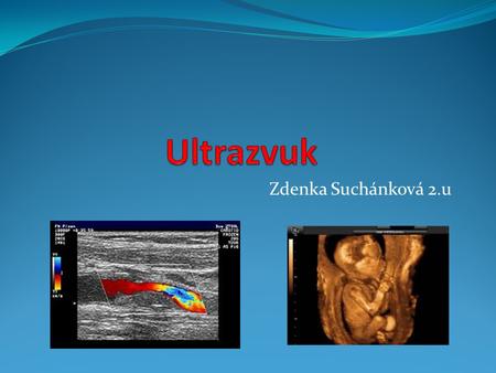 Ultrazvuk Zdenka Suchánková 2.u.