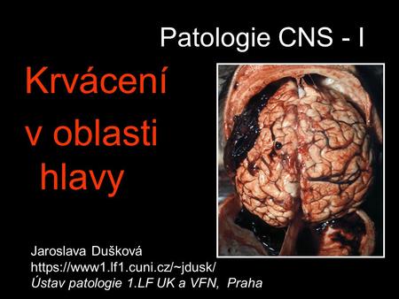 Krvácení v oblasti hlavy Patologie CNS - I Jaroslava Dušková