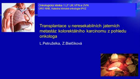 Transplantace u neresekabilních jaterních metastáz kolorektálního karcinomu z pohledu onkologa L.Petruželka, Z.Bielčiková Onkologická klinika 1.LF UK VFN.