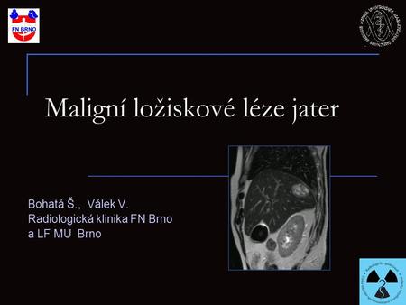 Maligní ložiskové léze jater Bohatá Š., Válek V. Radiologická klinika FN Brno a LF MU Brno.