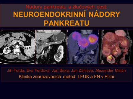 Nádory pankreatu a žlučových cest: NEUROENDOKRINNÍ NÁDORY PANKREATU