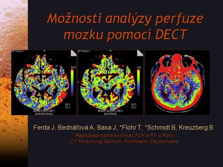 Možnosti analýzy perfuze mozku pomocí DECT