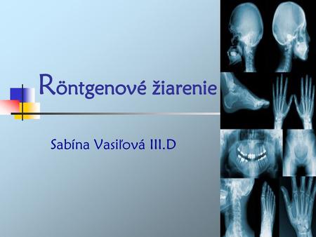 Röntgenové žiarenie Sabína Vasiľová III.D.