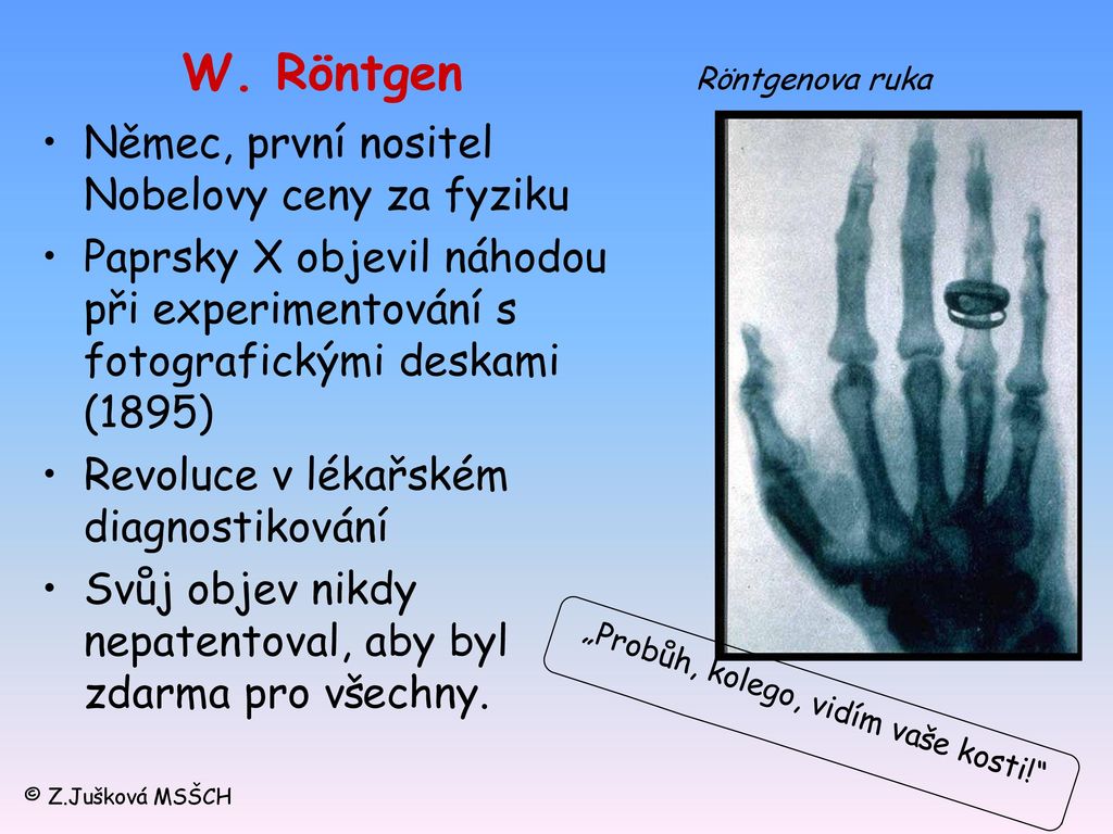 W. Röntgen Röntgenova ruka