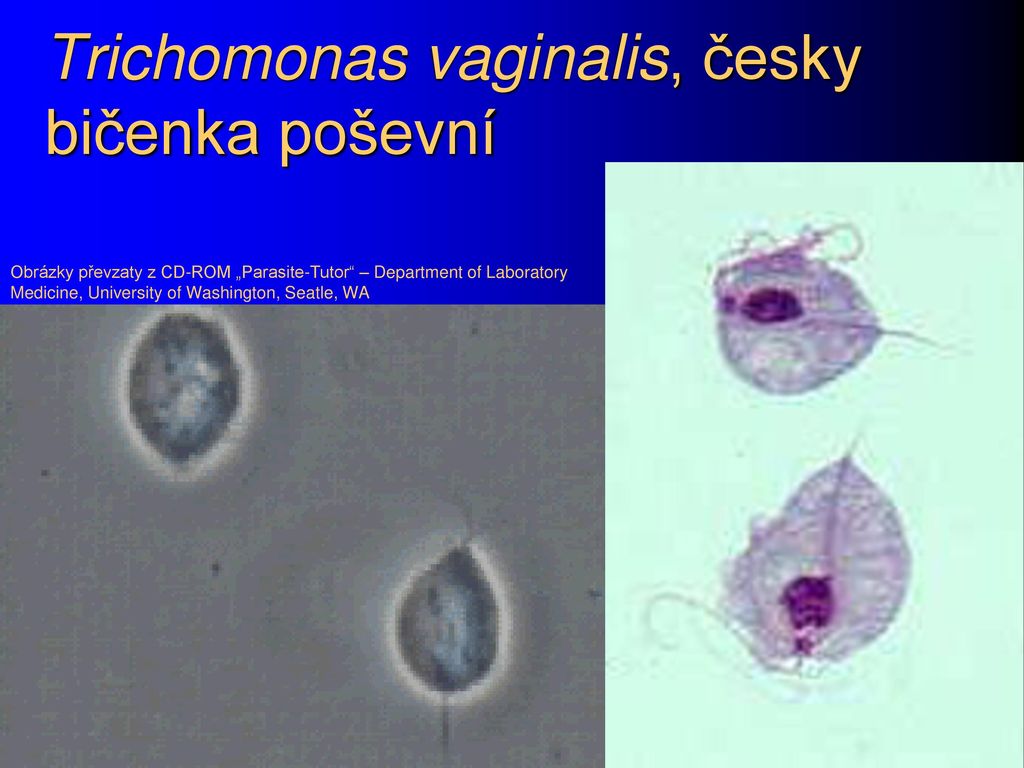 Trichomonas vaginalis пцр