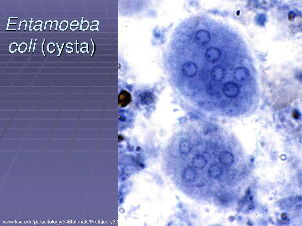 Заболевания вызванные амебами. Entamoeba histolytica циста. Цисты Entamoeba. Дизентерийная амеба (Entamoeba histolytica). Entamoeba histolytica под микроскопом.