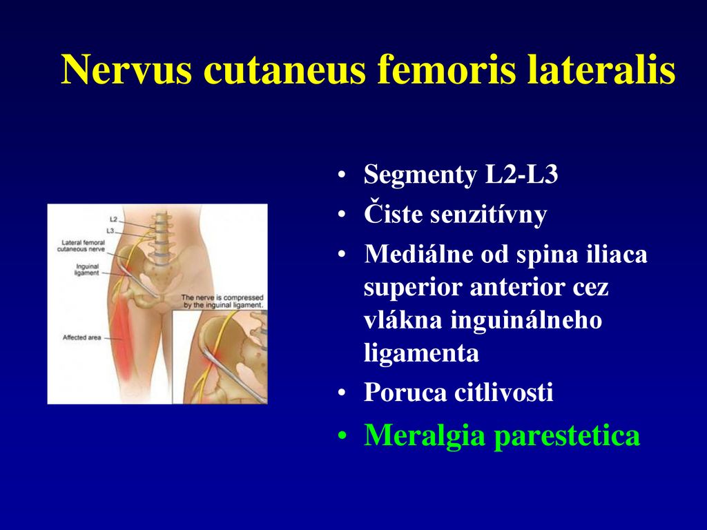 Nervus cutaneus femoris lateralis