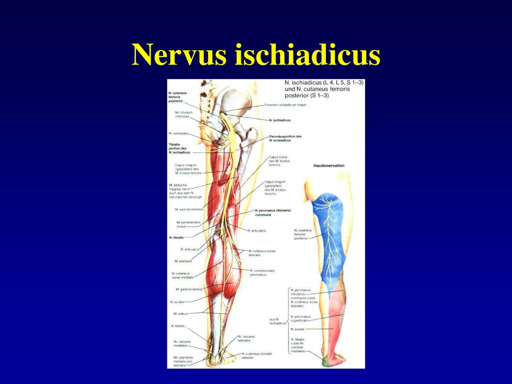 Nervus ischiadicus