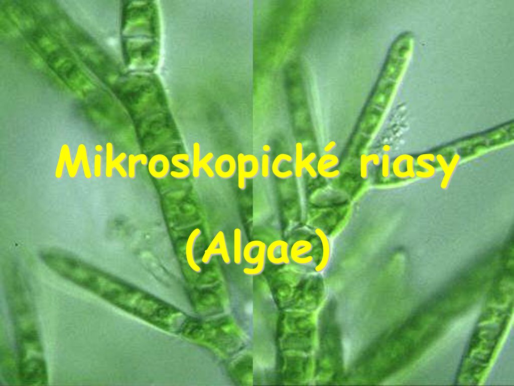 Mikroskopické riasy (Algae). - ppt stáhnout