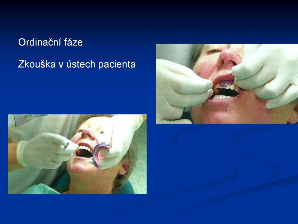 Ordinační fáze Zkouška v ústech pacienta