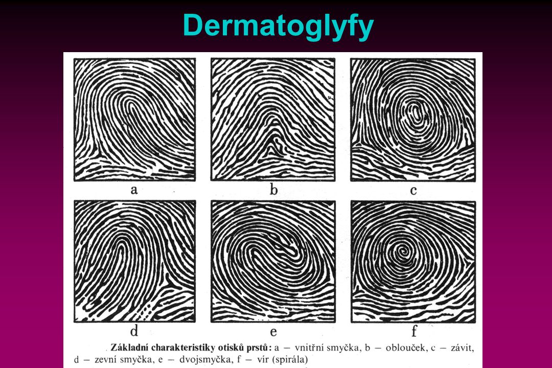 Dermatoglyfy