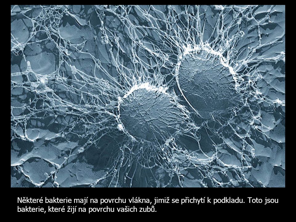 Některé bakterie mají na povrchu vlákna, jimiž se přichytí k podkladu