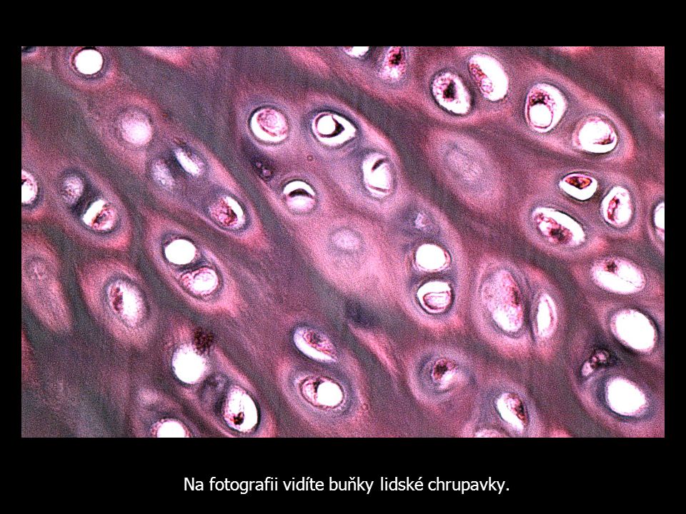 Na fotografii vidíte buňky lidské chrupavky.