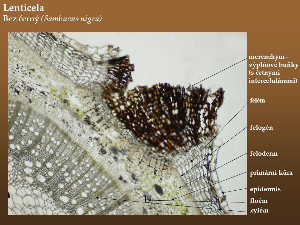 Lenticela Bez černý (Sambucus nigra) merenchym - výplňové buňky