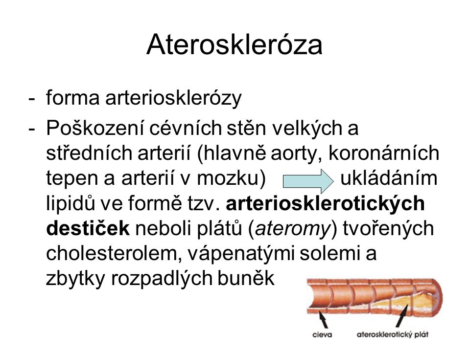 Ateroskleróza forma arteriosklerózy