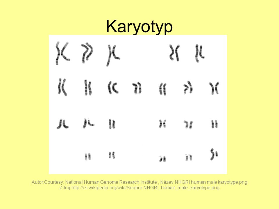 Karyotyp Autor:Courtesy: National Human Genome Research Institute , Název:NHGRI human male karyotype.png.