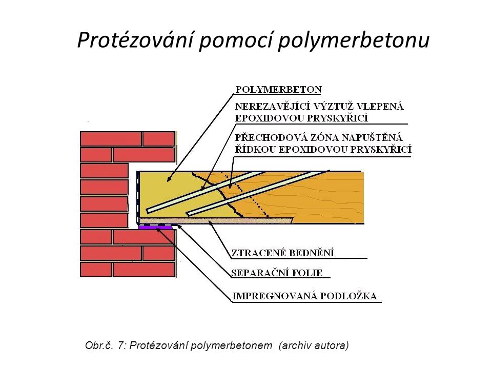 Protézování pomocí polymerbetonu