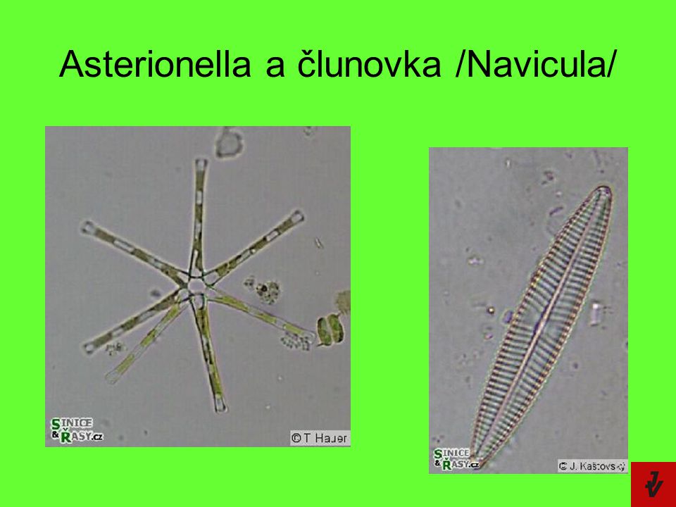 Asterionella a člunovka /Navicula/